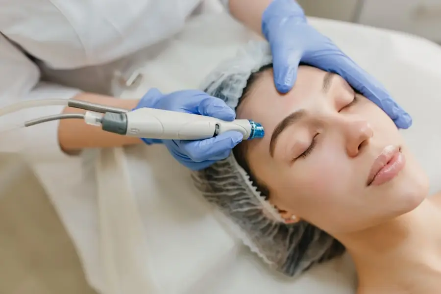 Laser skin treatment applied to the face in a clinic